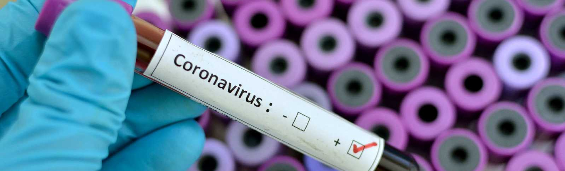 Coronavirus: Derechos de los pasajeros a la hora de posponer o cancelar sus viajes